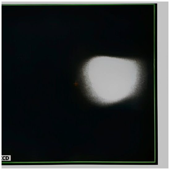 While wobble the coupling lens, Slit image is moving horizontally, it's moving away from the screen centre